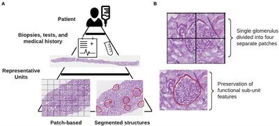 From What to Why, the Growing Need for a Focus Shift Toward Explainability of AI in Digital Pathology